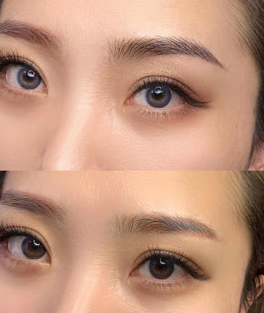 匠小白普及帖 纹眉后的恢复过程全知道 腾讯新闻
