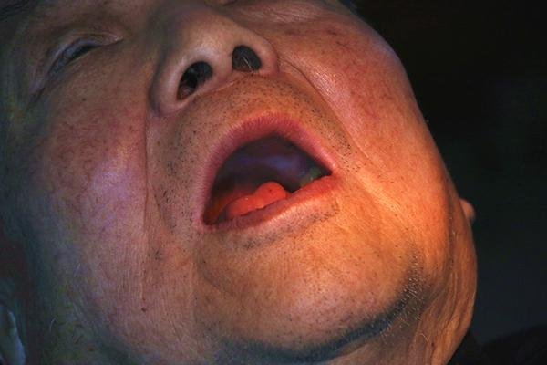 身体里有炎症如果拖着不治多久后就变成癌了3种炎症别忽视