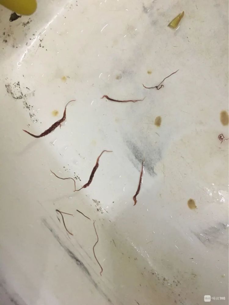 水槽这些寄生虫怎么办啊!我吓死了!天天开水烫!