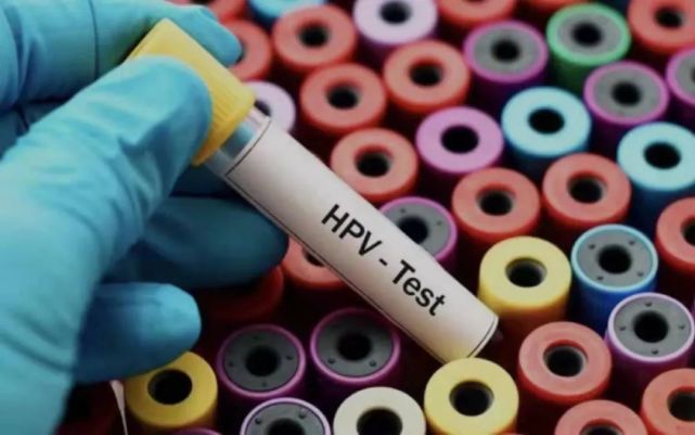 科室动态病理科我院病理科将开展hpv病毒检测新项目