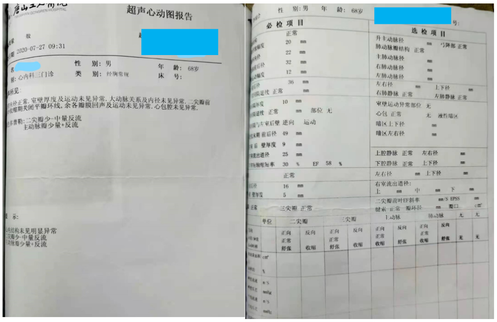 精彩病例丨cdqi名家面对面第三十二期 冠心病合并房颤患者综合治疗一例 腾讯新闻