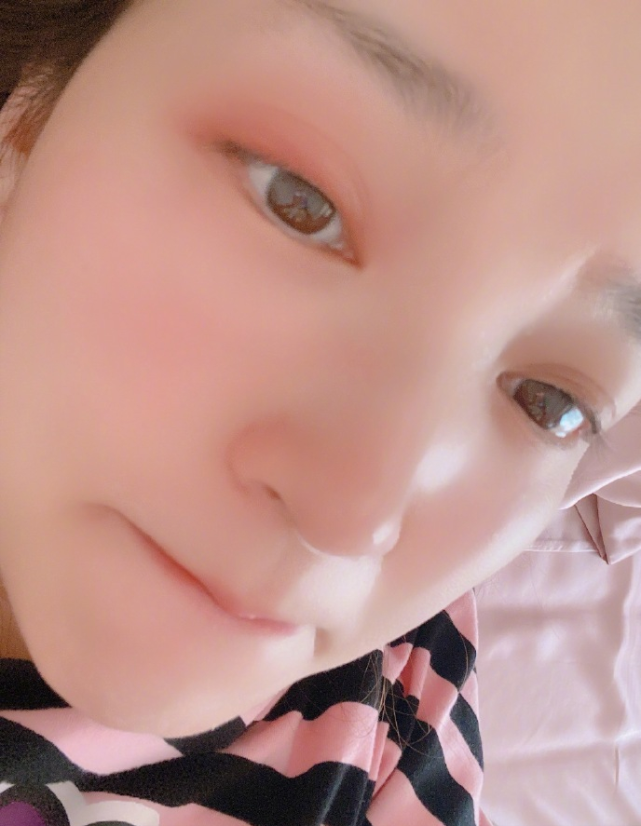 金莎又搞美图营销?晒出怼脸三连拍照,美颜开到了极致的样子