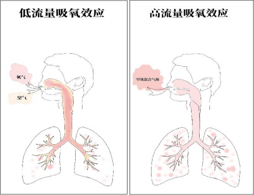 氧疗装置到底该怎么选氧流量怎样设置你的做法很可能是