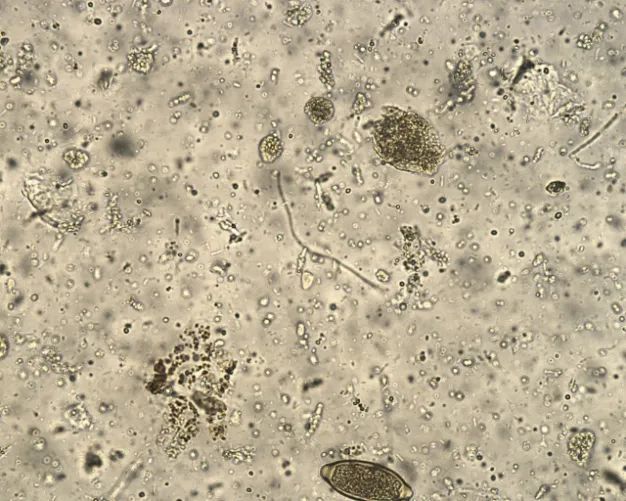 小朋友不养成良好的卫生习惯,可能会感染鞭虫病