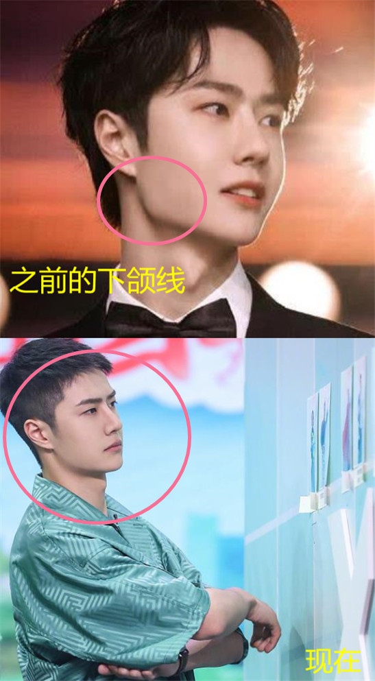 还不到25岁王一博却开始老了法令纹变深下颌线变圆润