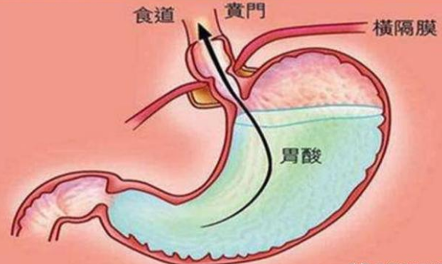 少吃多餐可以减轻胃的负担;墨妈孕晚期的时候经常容易