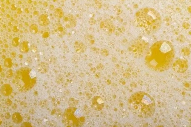 上厕所时,出现这些奇怪现象,说明尿酸过高了,不妨一起了解下