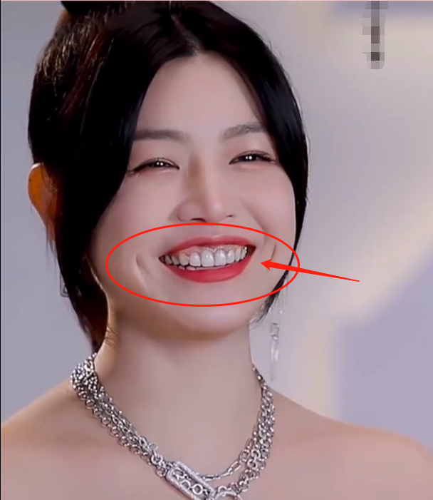 一口假牙价值百万豪宅整完嘴都包不住刘涛马思纯都被它害了