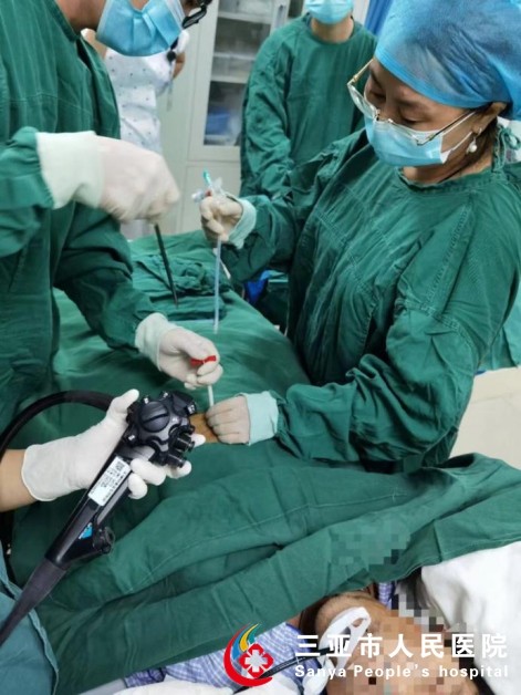 三亚市人民医院成功开展超细胃镜引导下经皮胃造瘘术