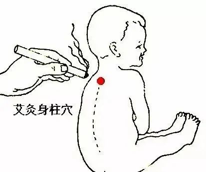儿童提高免疫力艾灸图图片