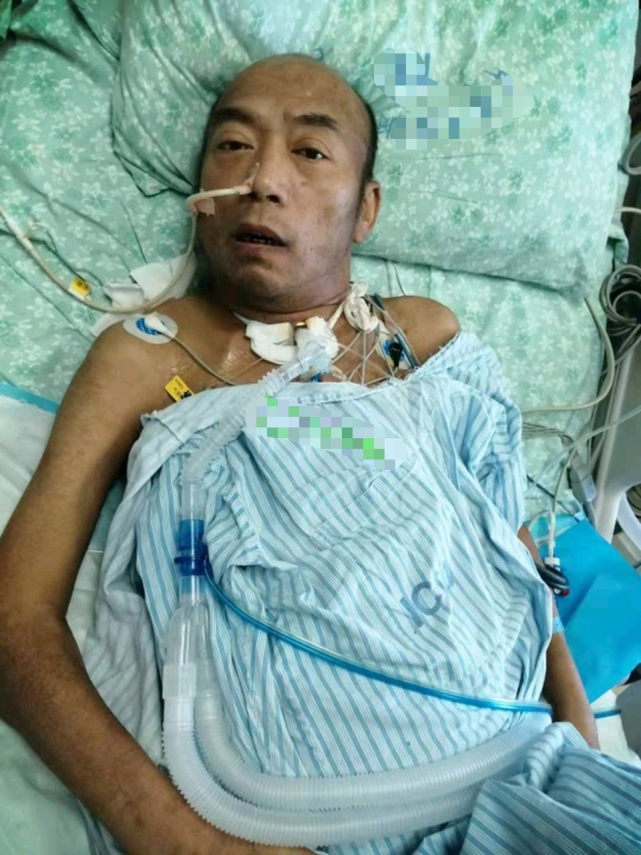 娱乐圈再传噩耗知名导演病危进重症室骨瘦如柴满身都是输液管