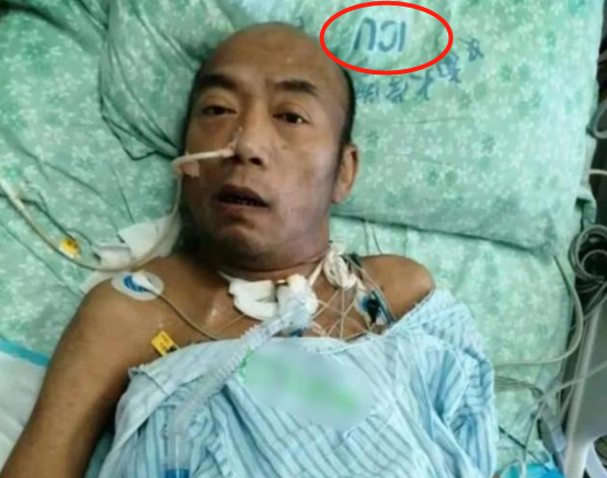 著名导演黄鹤病危近照骨瘦如柴面色蜡黄发黑身上插满数条导管