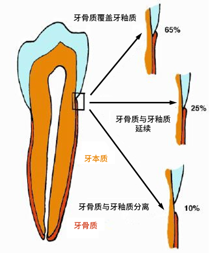 是谁,把牙齿送上了 断头台?