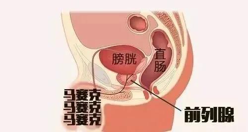 年轻男性前列腺增大五个症状很明显
