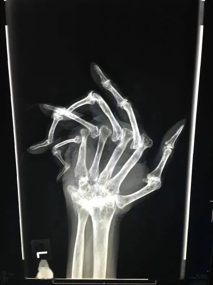 一组诡异的x光照片,乍看之下有点吓人!