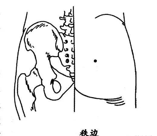 取穴:秩边穴.属足太阳膀胱经.在臀部,平第4骶后孔,骶骨正中旁开3寸处.