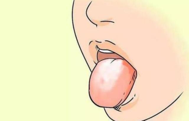 血糖高不高,舌头有"警报"?若没有3个现象,可能血糖还算平稳