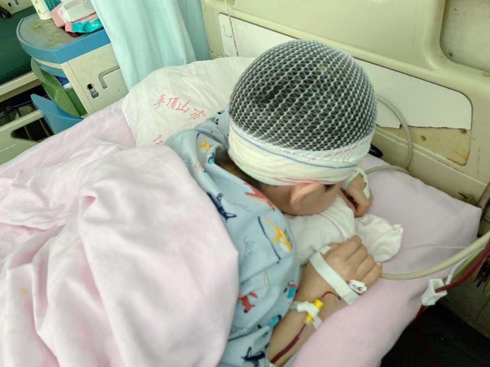 9岁男童被老师体罚致头皮头骨分离家长孩子住院期间历经7次穿刺手术