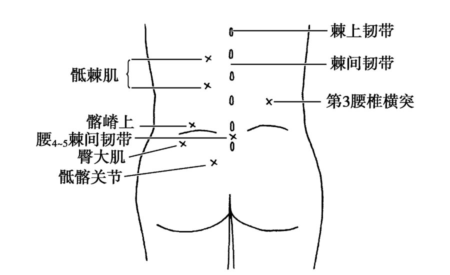 門診最常見的下腰痛其實並不簡單