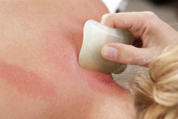 刮痧刮出来的痧是什么是身体在排毒出痧越多越好