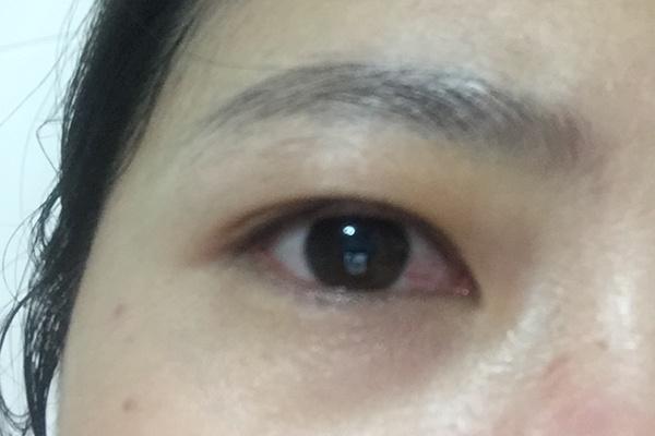 肝不好脸会告诉你脸上若有以下表现说明肝不太好该养肝了