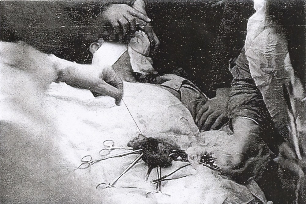 当时的九州帝国大学医学部正在展开一场匪夷所思的实验,为了弥补战场