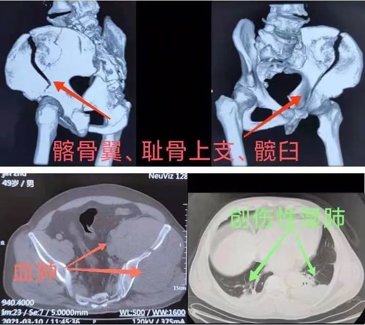 复杂手术与微创观念兼备介入技术为传统诊疗护航 腾讯新闻