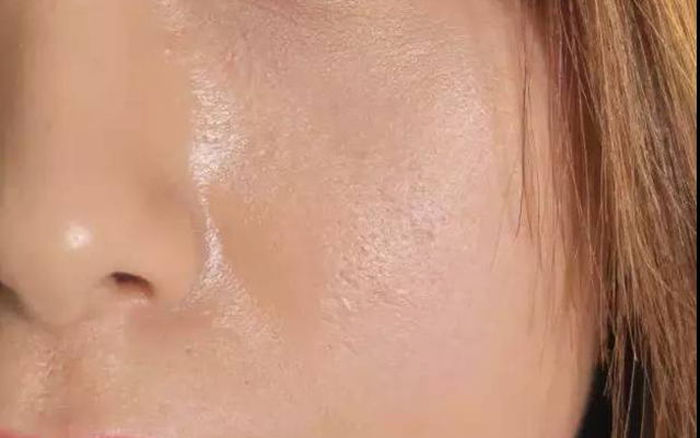 夏天来了,我脸上总是油腻腻的怎么办?_腾讯新闻