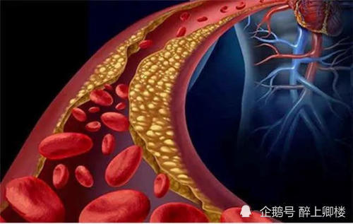 血液粘稠吃什么这几种种食物有效降低血液黏度