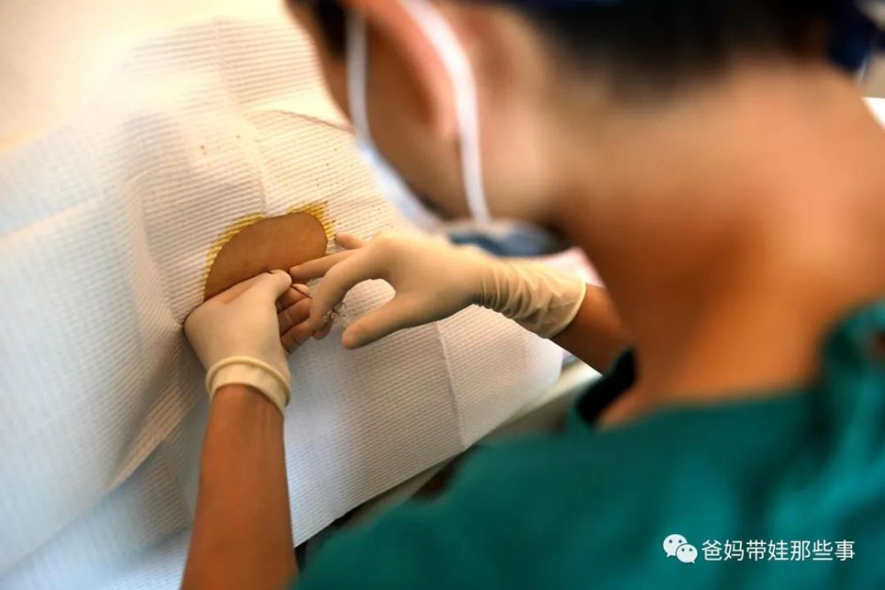 生孩子遇到男医生"一阳指",是种怎样的体验?_腾讯新闻