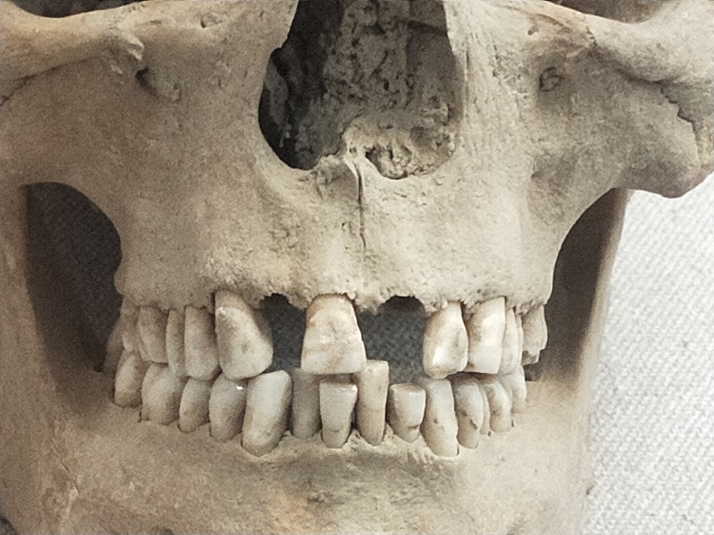 小编拍摄的阿敦乔鲁古人类牙齿如果把地球上的现有人种归为一个大类的