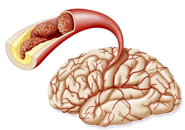 01.大脑供血不足的人,可以试着吃这三种蔬菜,或者帮助软化血管.