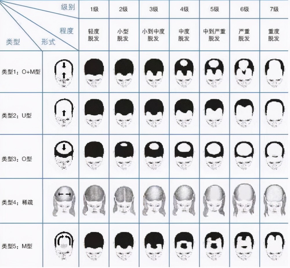 但是,即使男人对衰老不在乎,也不想20多岁的年龄,却拥有着40多岁的