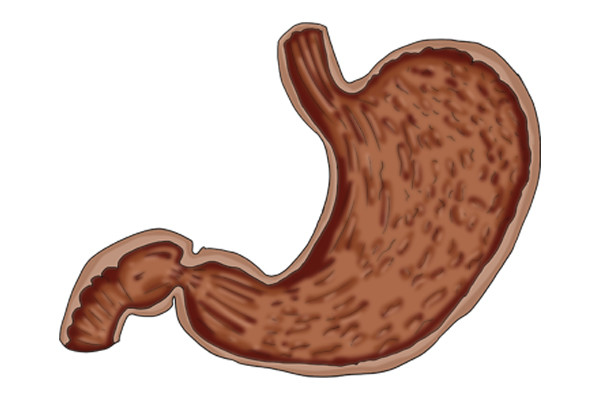 他们的胃黏膜受到损伤,需要及时的修复才能够恢复正常,在饮食上建议