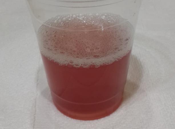 1,晨尿颜色深一,肝不好的人,晨起后的4种异常