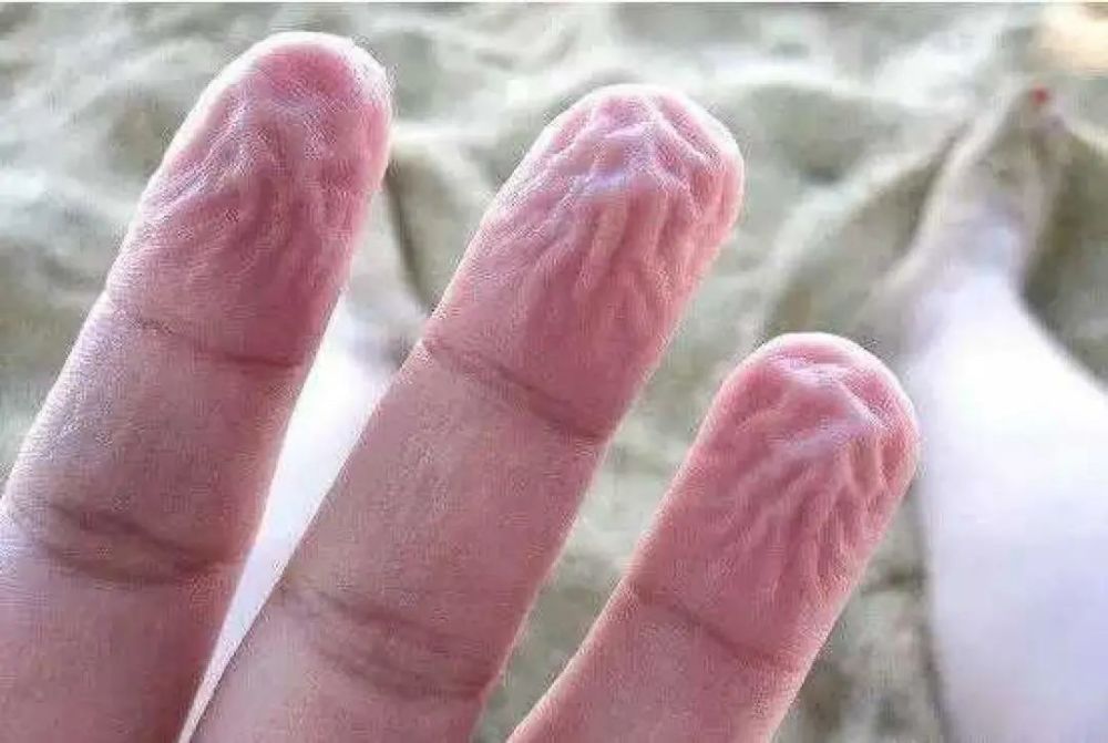 泡水后手指会起皱，为什么别的地方就不会？_腾讯新闻