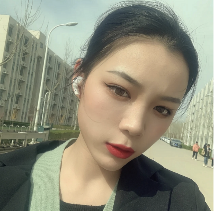 25岁女生皮肤暗黄长黄褐斑皮肤医师建议日常少做2事不做黄脸婆