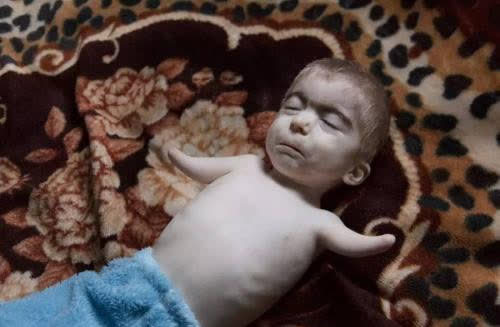 切尔诺贝利老照片周围60里都成了禁区变异的毒蛇有两个头