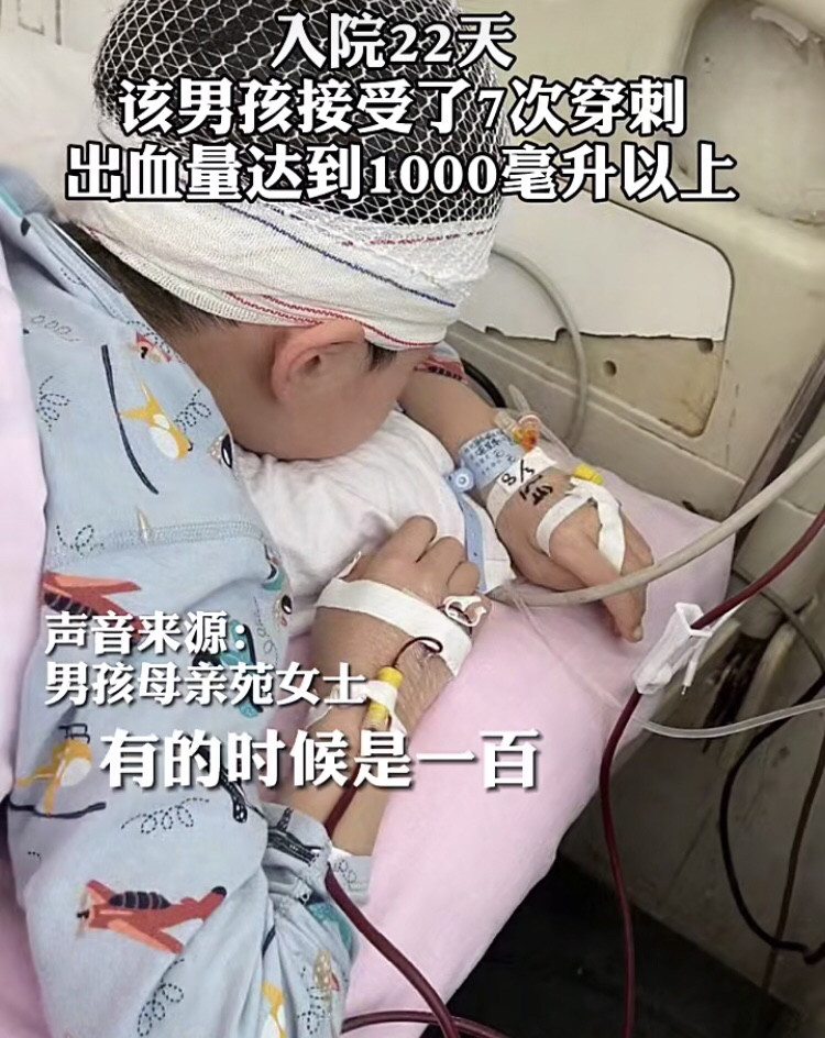 河南九岁男孩被老师拖至头皮头骨分离，该老师20天后才停职。