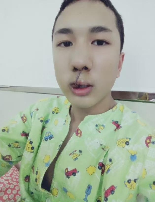 韩佩泉晒唇裂时期照片呼吁患者勇敢微笑正能量满满