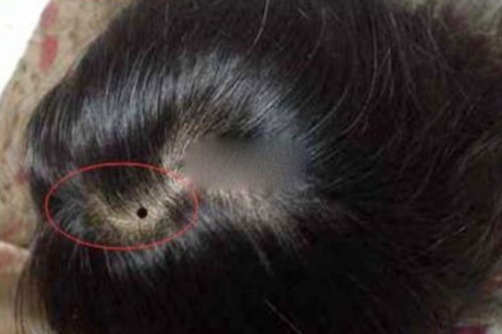 宝宝这4个部位有"痣",是有福气的象征,中的家长要偷着乐了