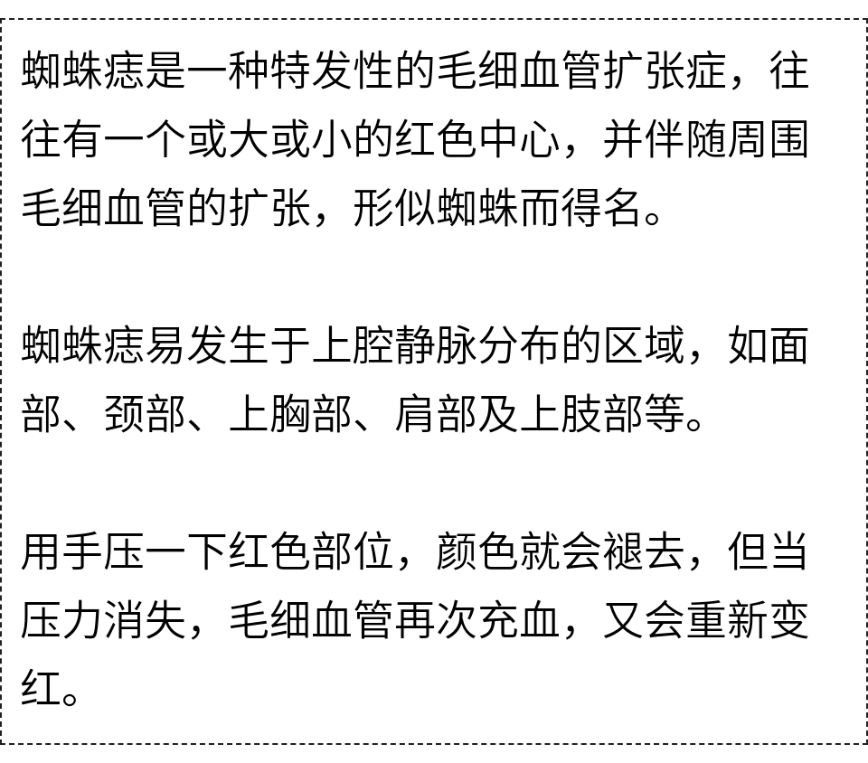 出血點血管痣來源:科普中國end【來源:北辰區疾控中心】版權歸原