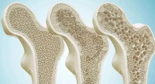 这3类"伤骨"蔬菜,建议尽量少吃,医生:日常中这3事可多做