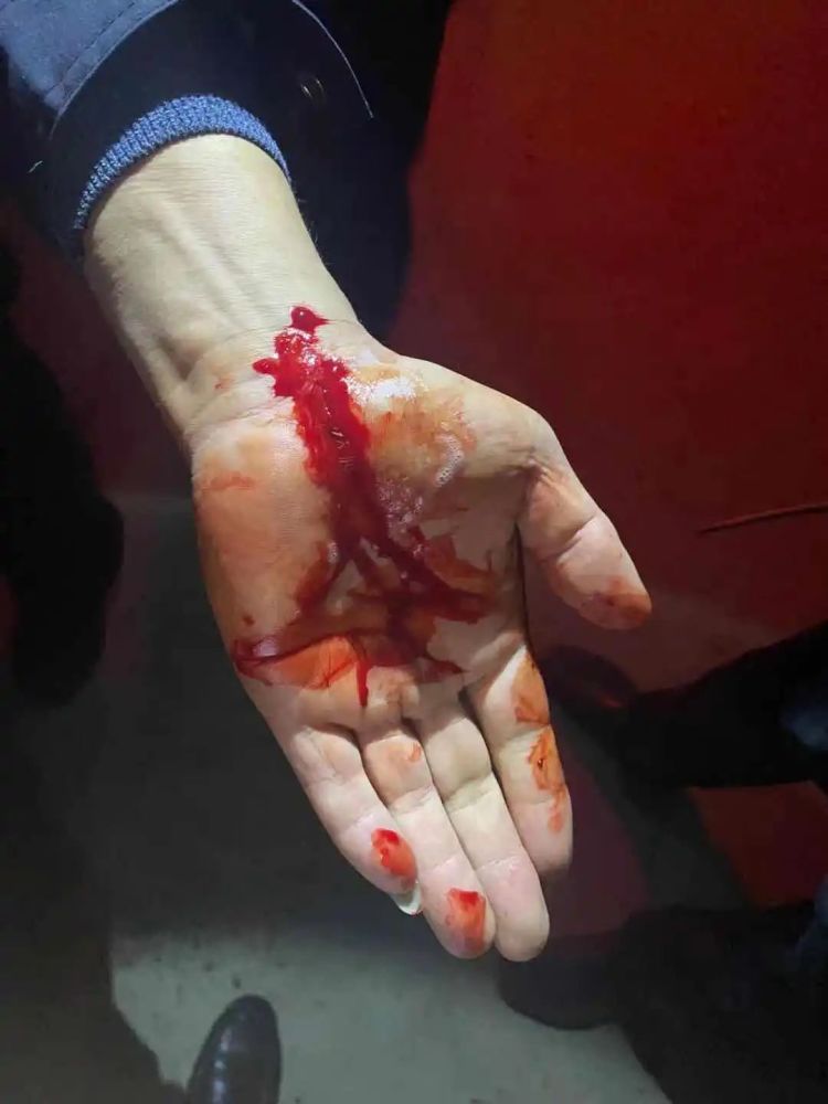 宝应一女武疯子持刀与警察pk