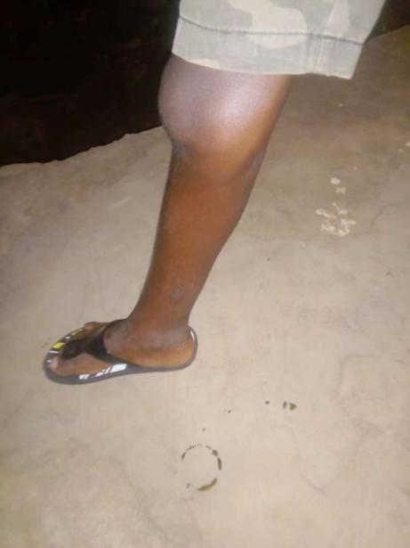 我在非洲治疗患蝇蛆病的男孩_腾讯新闻