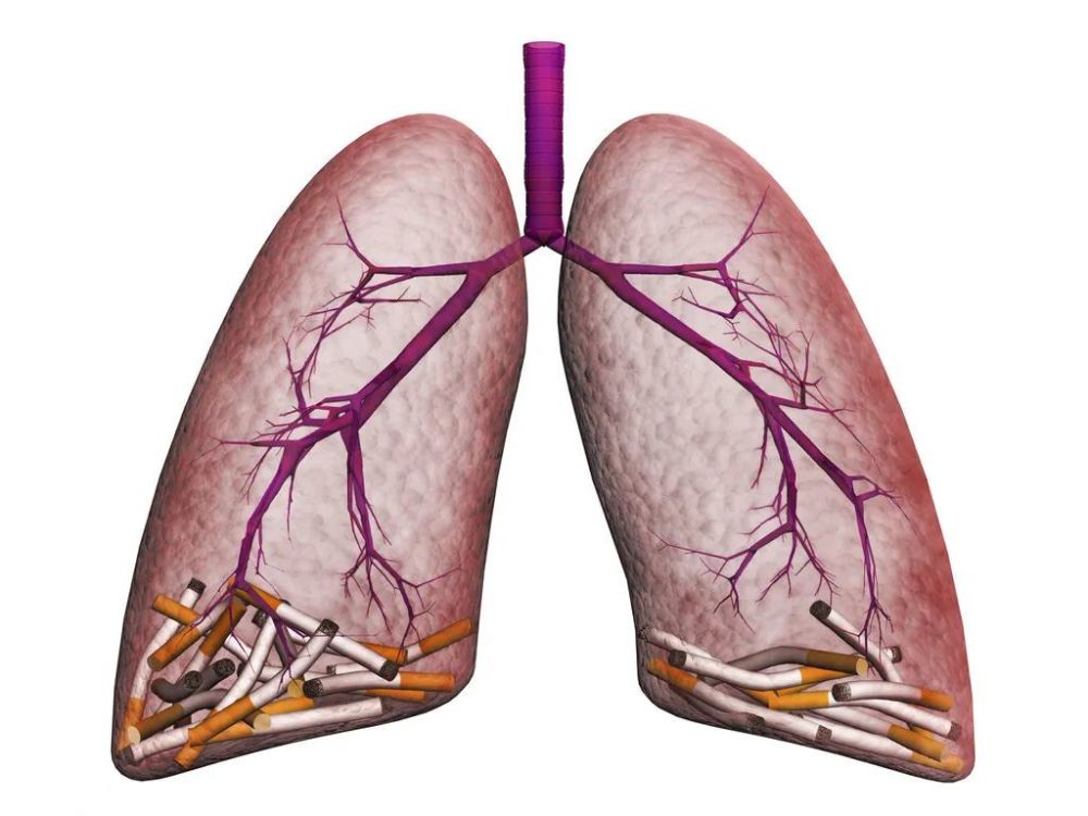 對於呼吸道來說可能會導致慢性的阻塞性疾病,也會導致肺部結構異常