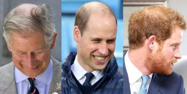英国王室基因超强大威廉王子秃顶夏洛特公主酷似英国女王
