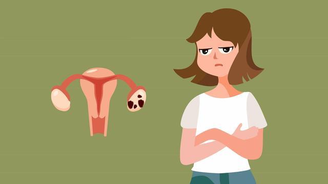 子宫好的女人,来月经时一般没有这4个表现,不妨对照自测一下