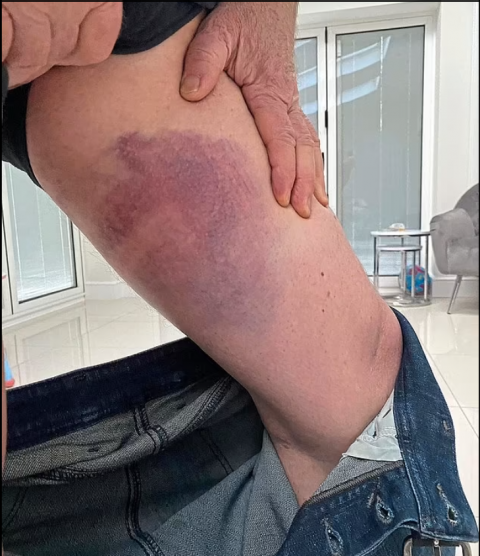 曼联球迷控诉警察他们打伤了我我们会再次大闹双红会的