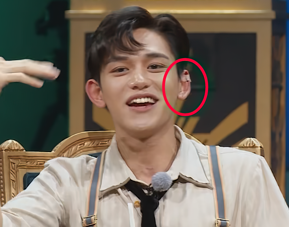 奔跑吧黄旭熙为啥把胶布粘在耳朵上得知真相后粉丝心疼了